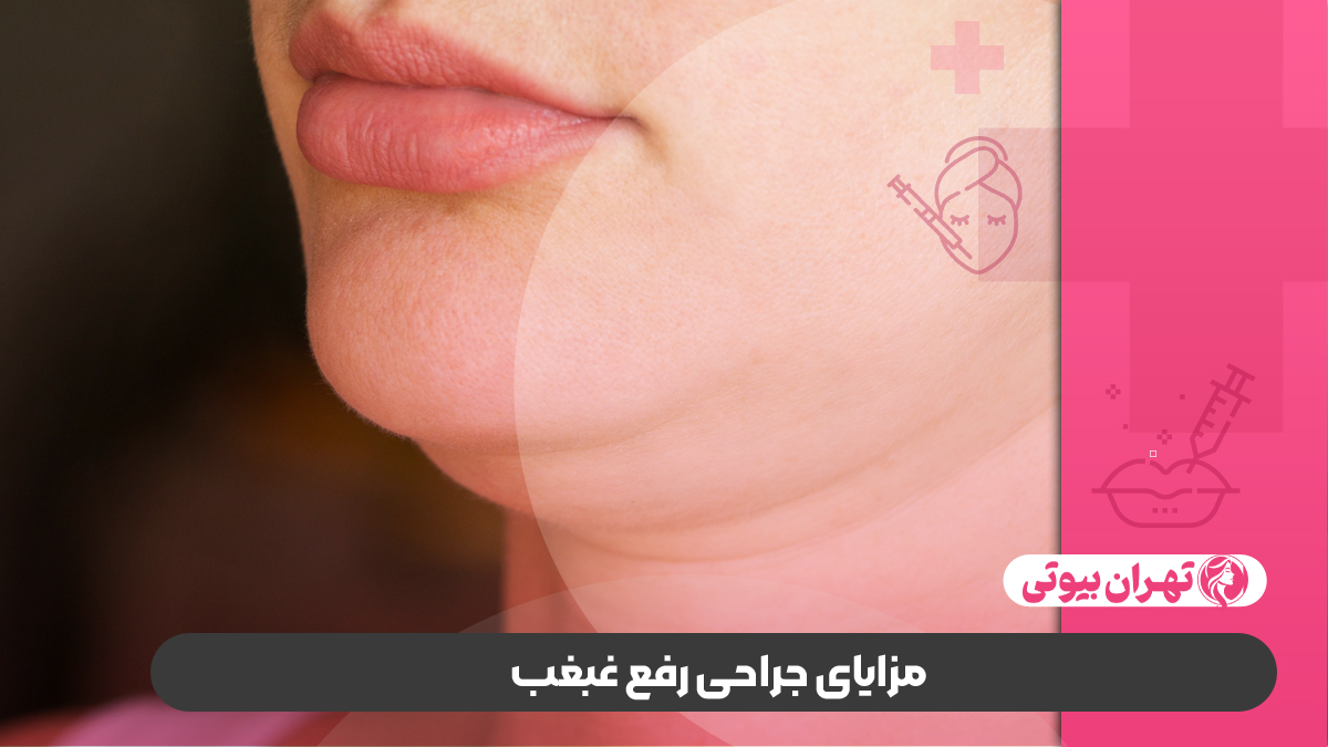 10 بهترین دکتر رفع غبغب در کرج