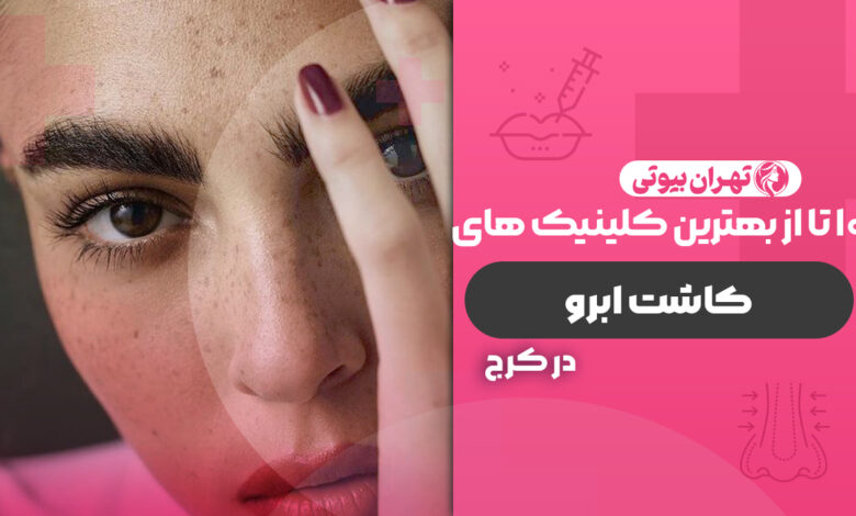 10 بهترین کلینیک کاشت ابرو در کرج