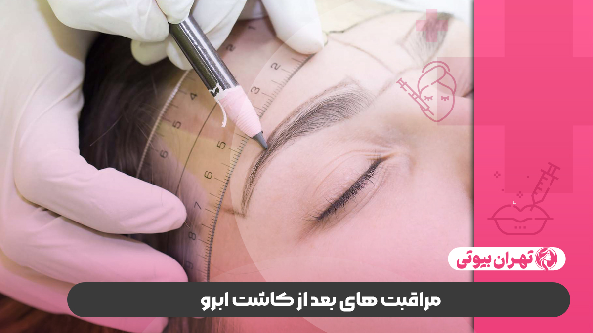 10 بهترین کلینیک کاشت ابرو در کرج