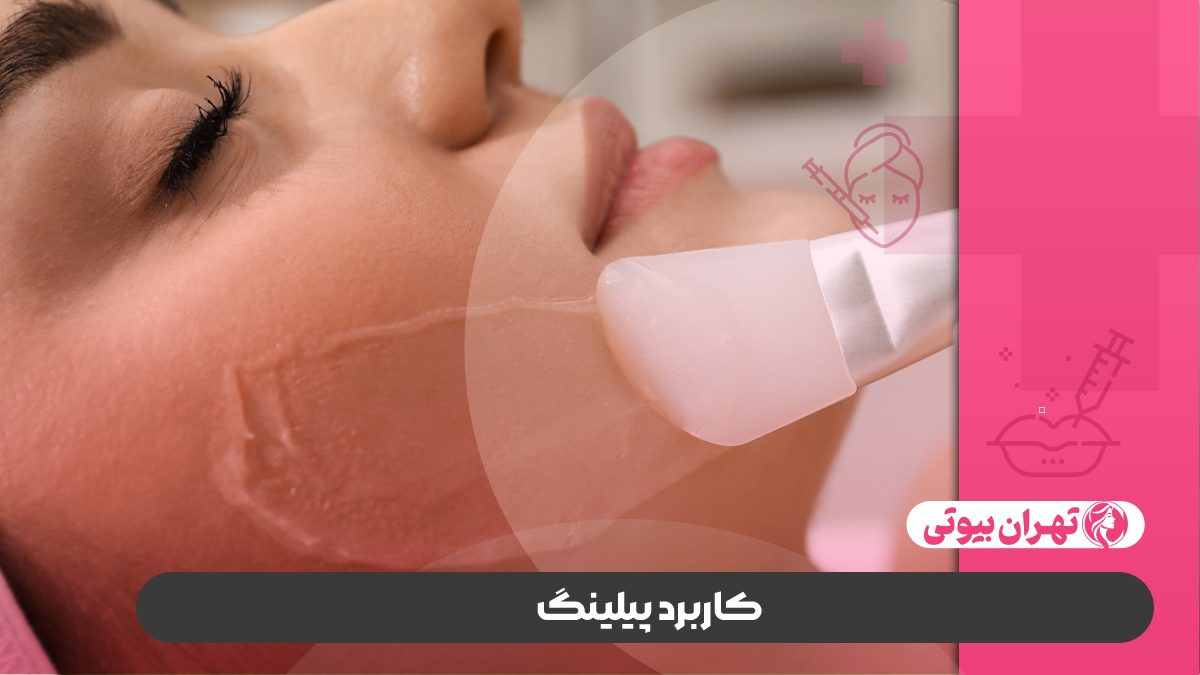 10 بهترین مرکز پیلینگ صورت در کرج