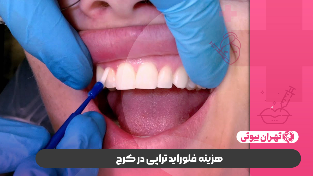 10 بهترین دکتر فلوراید تراپی در کرج