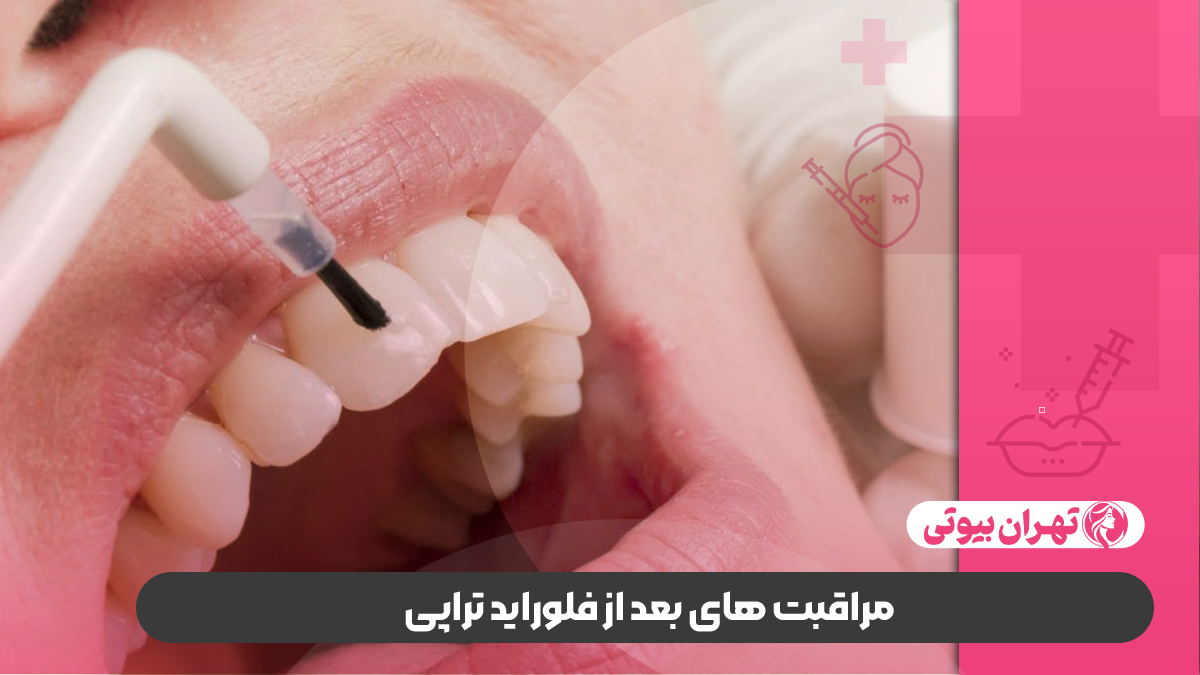 10 بهترین دکتر فلوراید تراپی در کرج