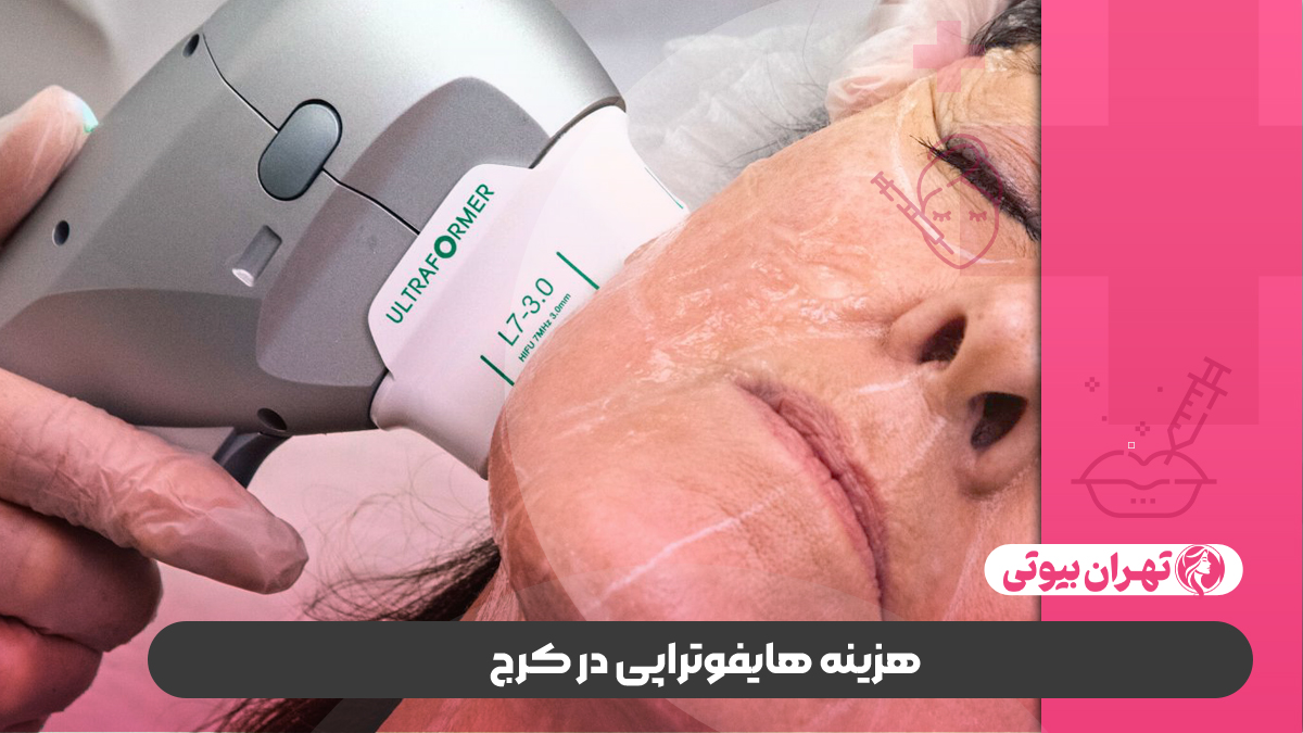 10 بهترین مرکز هایفوتراپی در کرج