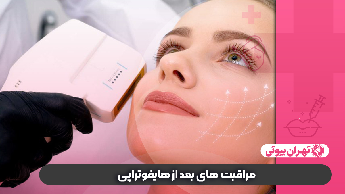 10 بهترین مرکز هایفوتراپی در کرج