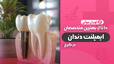 10 بهترین متخصص ایمپلنت دندان در کرج