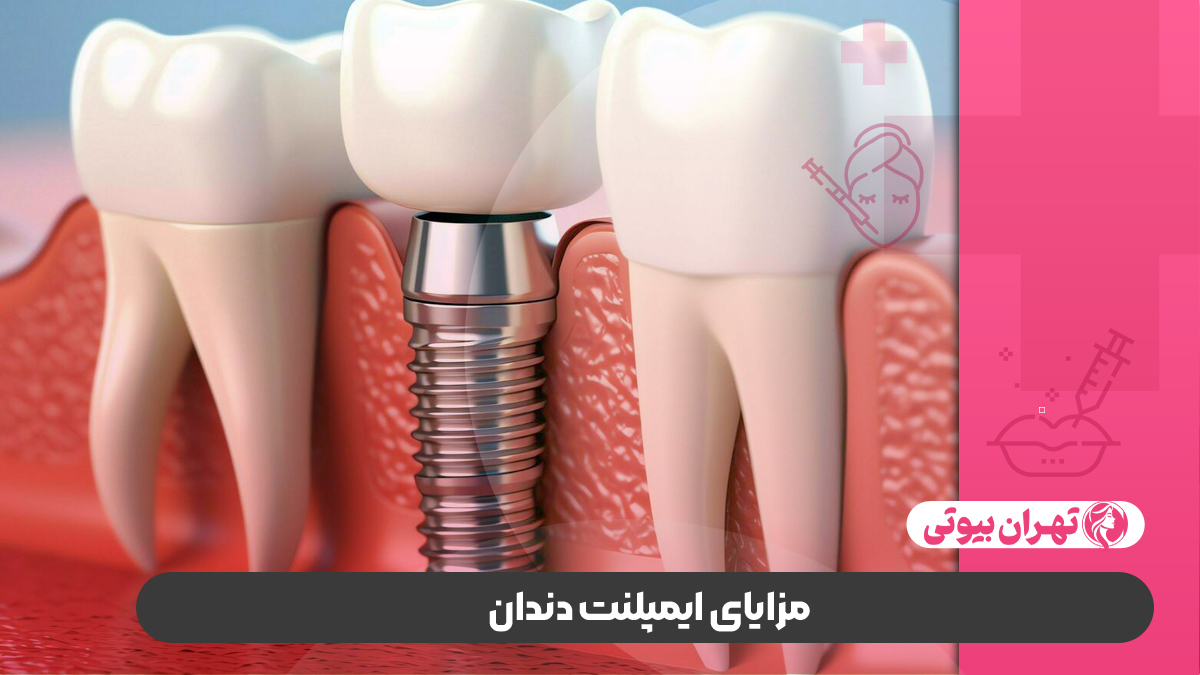 10 بهترین متخصص ایمپلنت دندان در کرج
