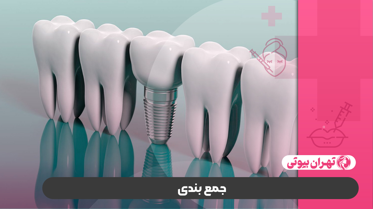 10 بهترین متخصص ایمپلنت دندان در کرج