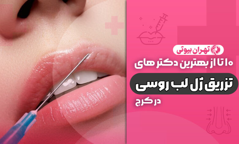 10 بهترین دکتر تزریق ژل لب روسی در کرج