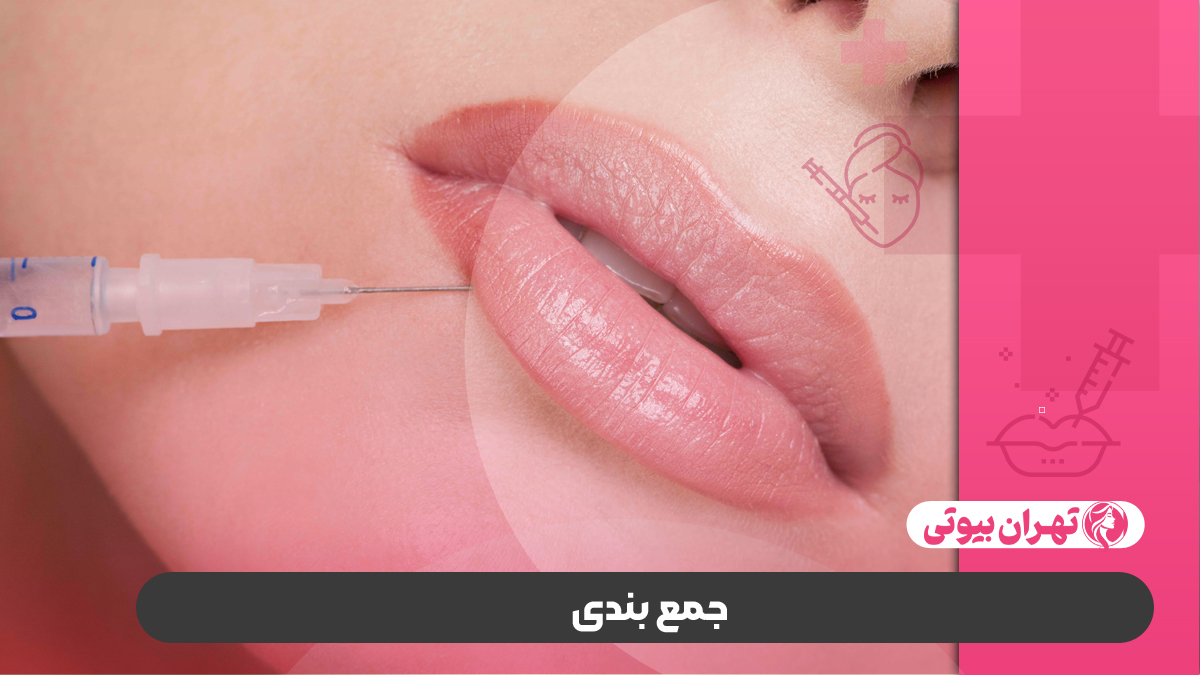 10 بهترین دکتر تزریق ژل لب روسی در کرج