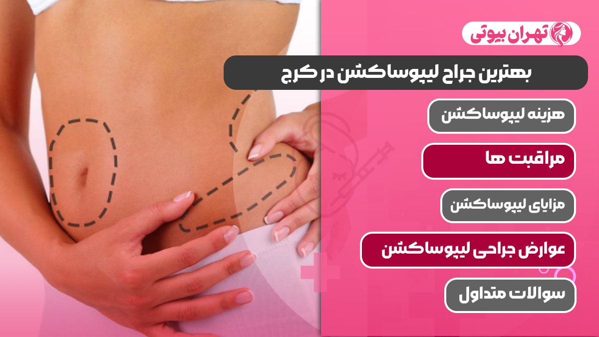 10 بهترین جراح لیپوساکشن در کرج