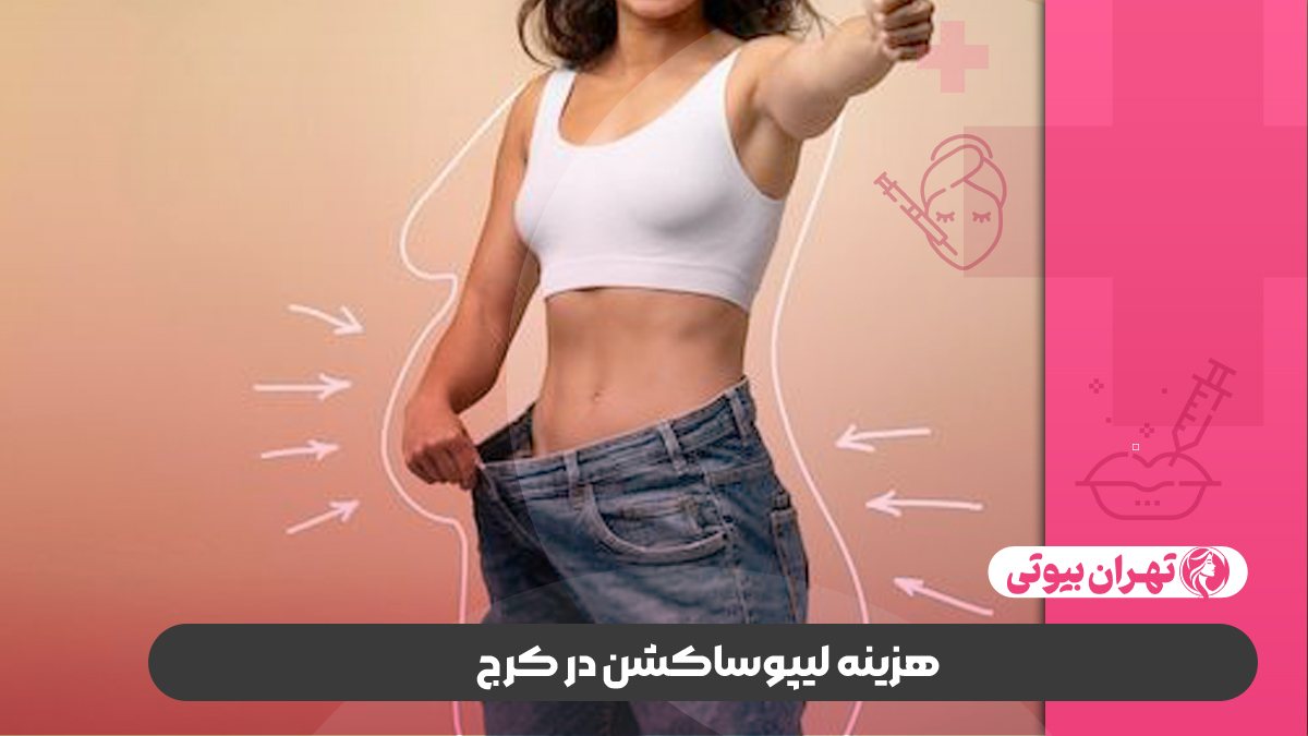 10 بهترین جراح لیپوساکشن در کرج