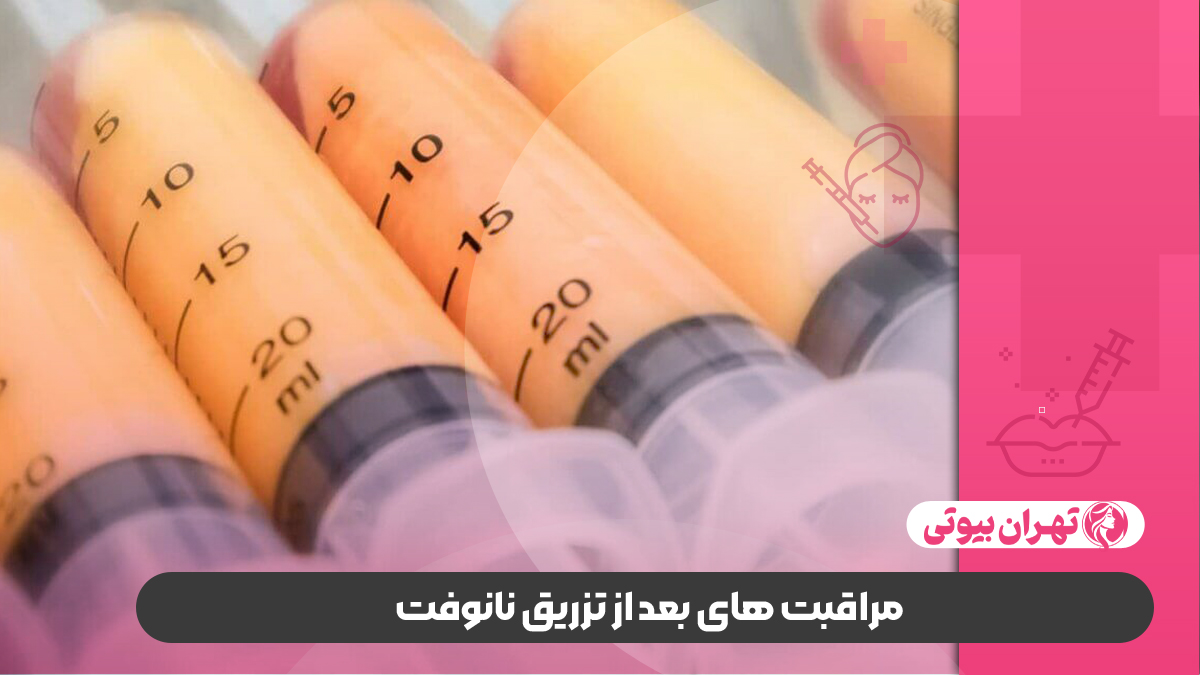 10 بهترین دکتر تزریق نانوفت در کرج