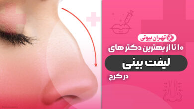 10 بهترین دکتر لیفت بینی در کرج