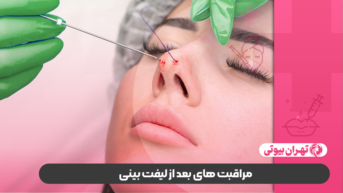 10 بهترین دکتر لیفت بینی در کرج