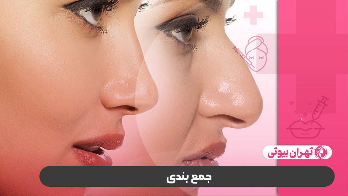 10 بهترین دکتر لیفت بینی در کرج