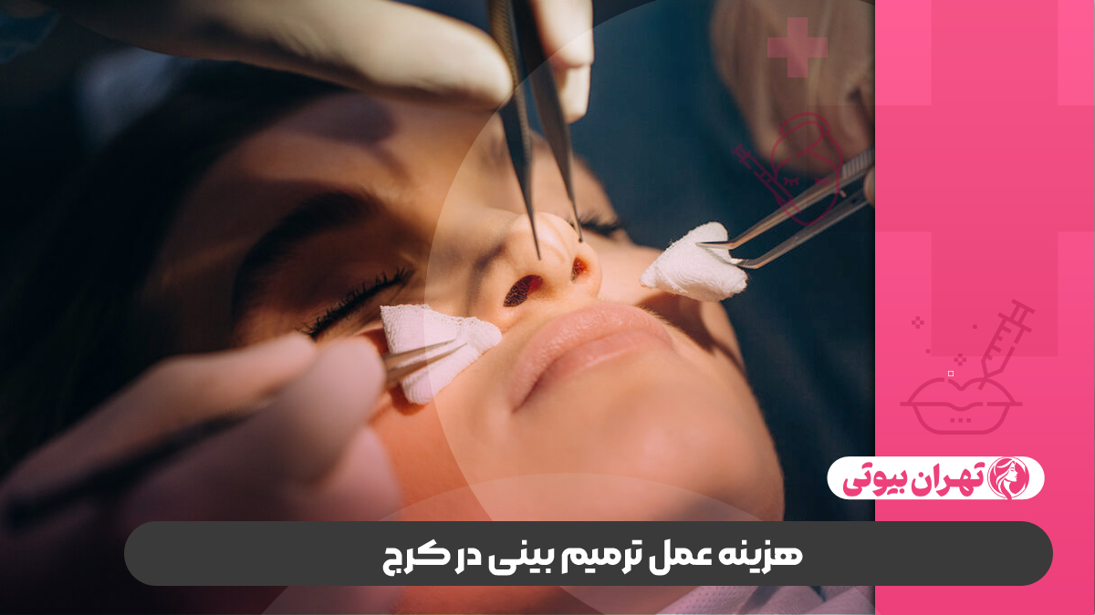 10 بهترین دکتر ترمیم بینی در کرج