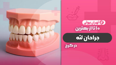 10 بهترین جراح لثه در کرج