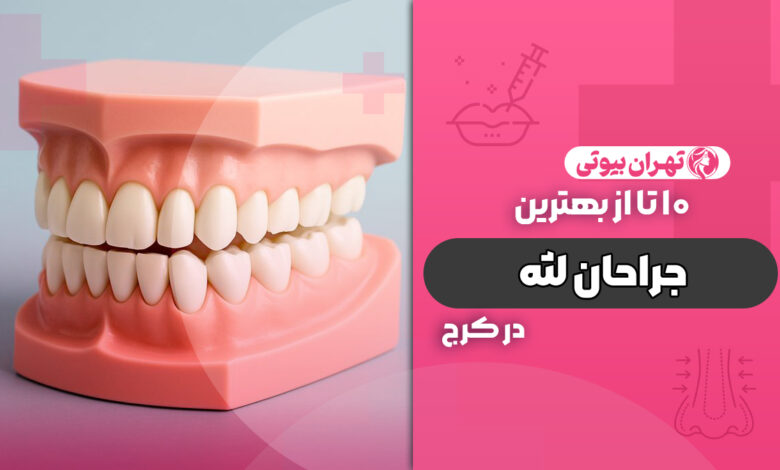 10 بهترین جراح لثه در کرج