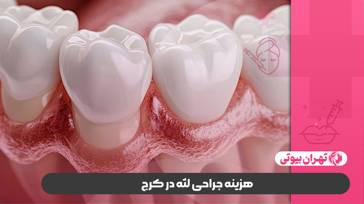 10 بهترین جراح لثه در کرج