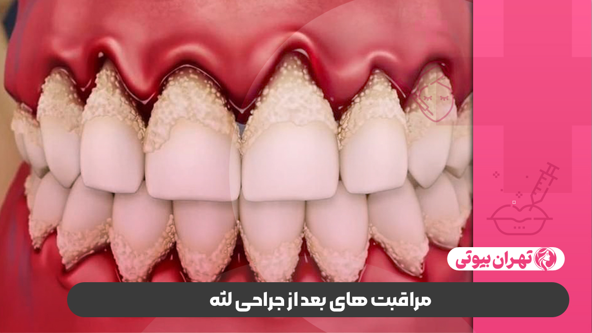 10 بهترین جراح لثه در کرج