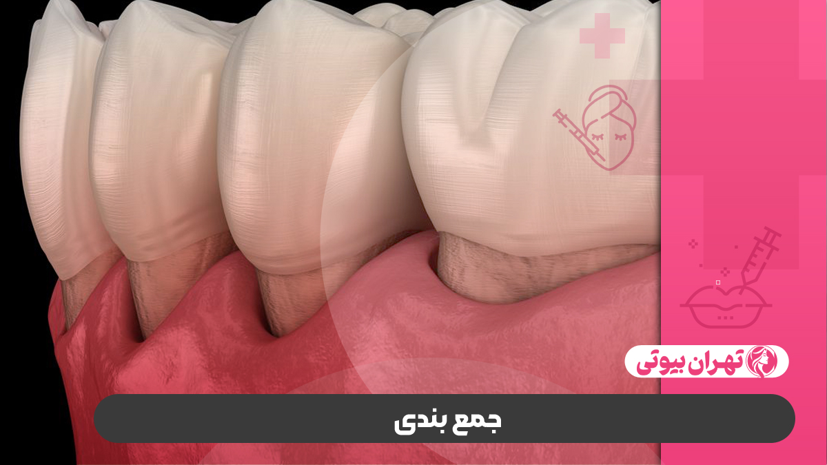 10 بهترین جراح لثه در کرج