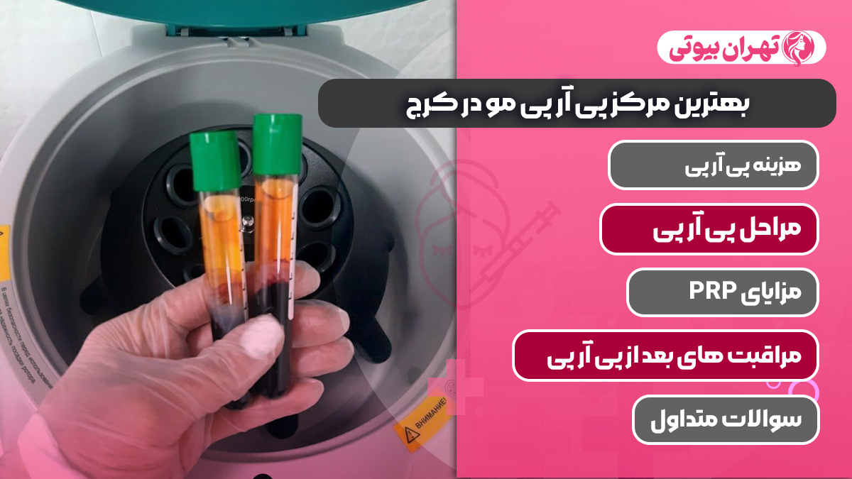 10 بهترین مرکز پی آر پی مو در کرج