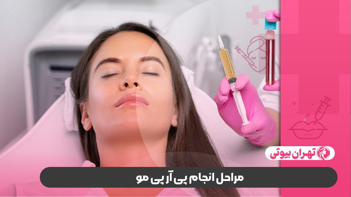 10 بهترین مرکز پی آر پی مو در کرج