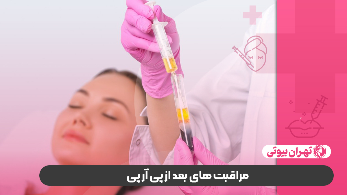 10 بهترین مرکز پی آر پی مو در کرج