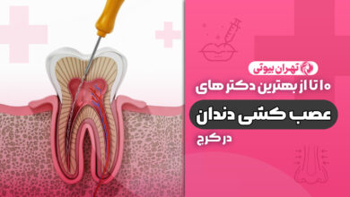 10 بهترین دکتر عصب کشی در کرج