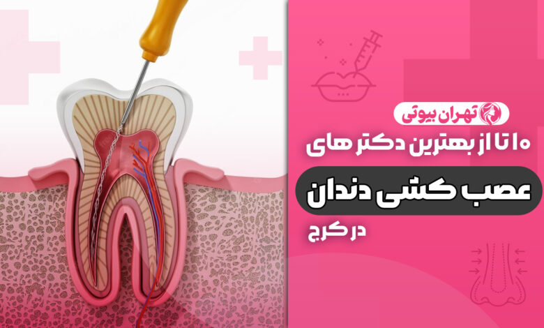 10 بهترین دکتر عصب کشی در کرج