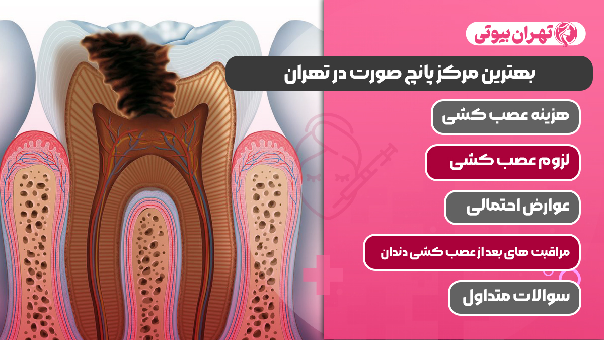 10 بهترین دکتر عصب کشی در کرج