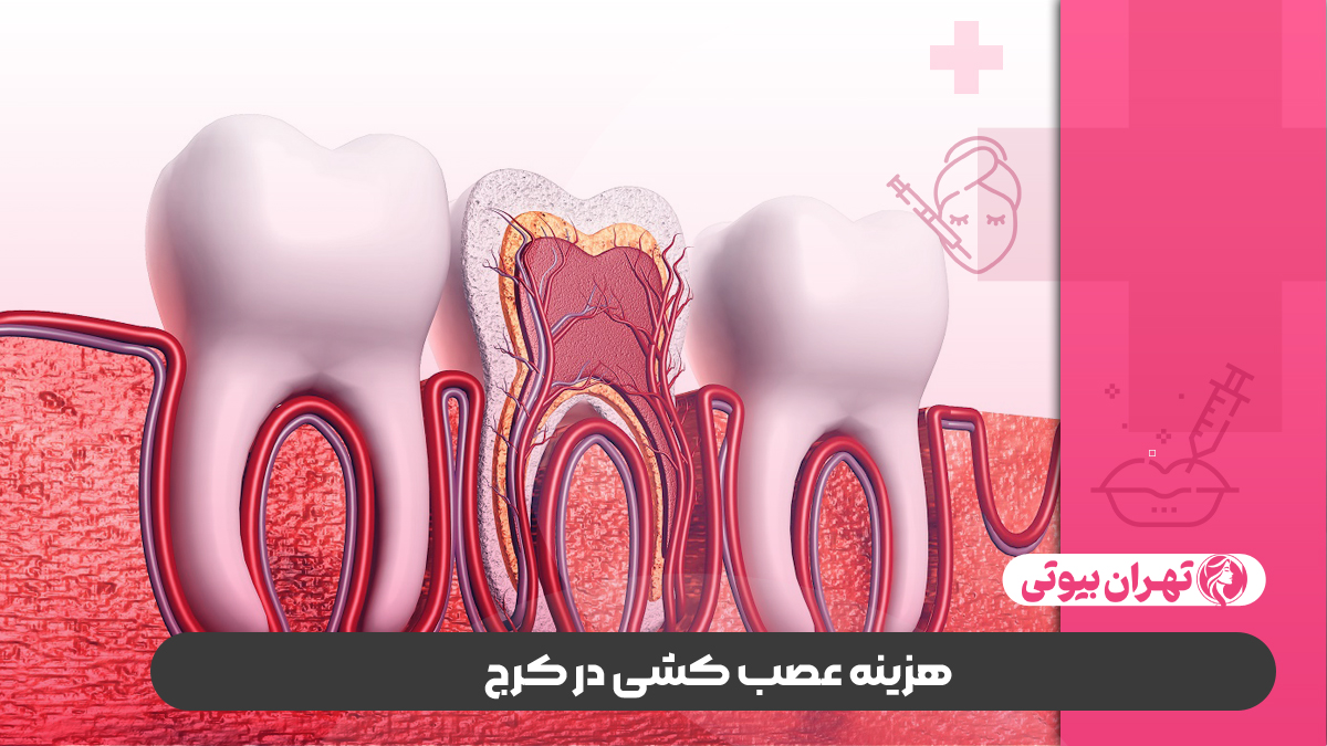 10 بهترین دکتر عصب کشی در کرج