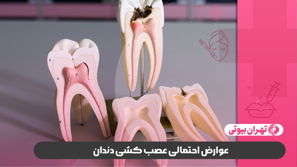 10 بهترین دکتر عصب کشی در کرج