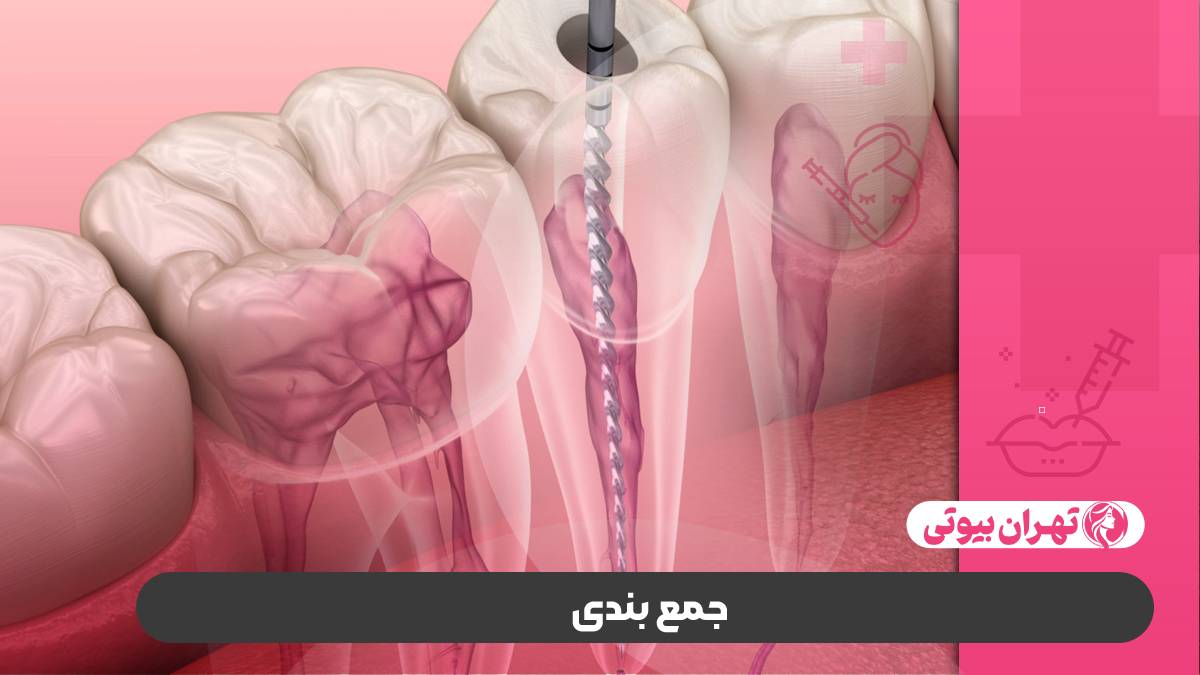 10 بهترین دکتر عصب کشی در کرج