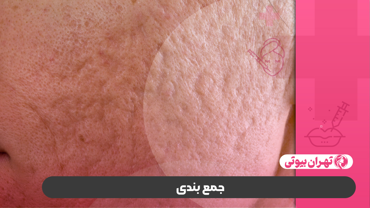 10 بهترین دکتر درمان اسکار در کرج