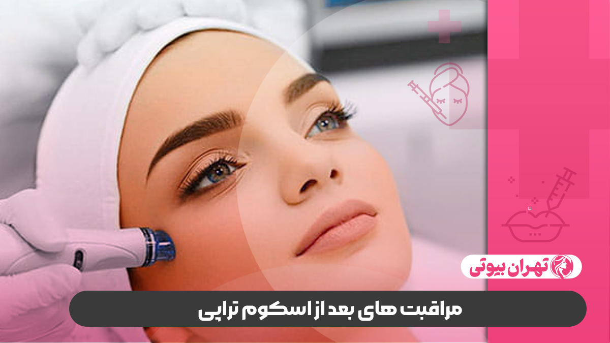 10 بهترین مرکز اسکوم تراپی در کرج