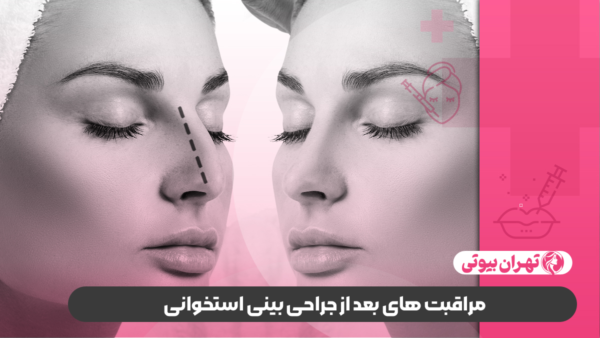 10 بهترین جراح بینی استخوانی در کرج