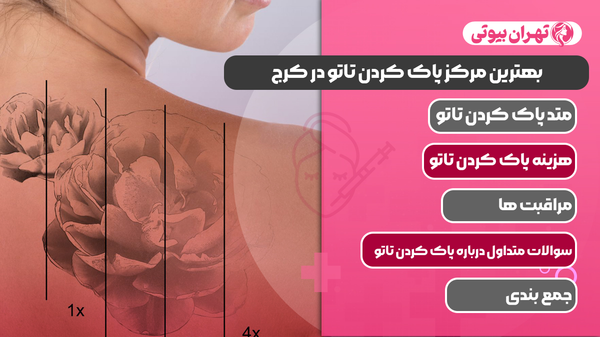 10 بهترین مرکز پاک کردن تاتو در کرج