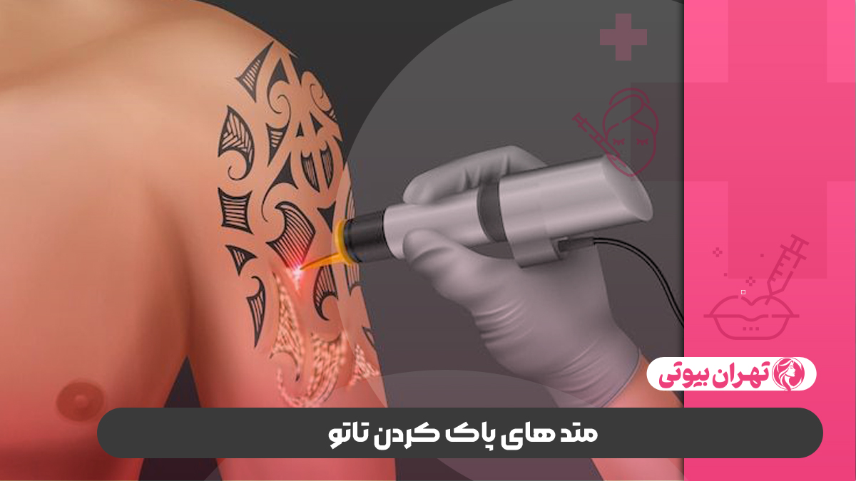 10 بهترین مرکز پاک کردن تاتو در کرج