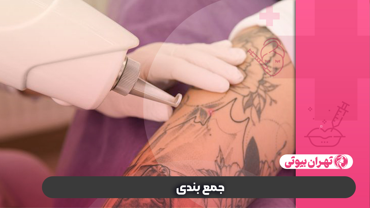 10 بهترین مرکز پاک کردن تاتو در کرج