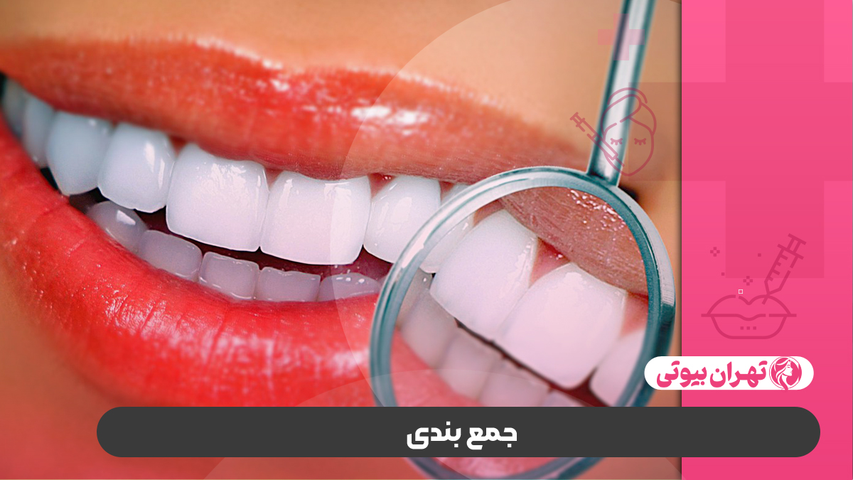 10 بهترین دکتر بلیچینگ دندان در کرج