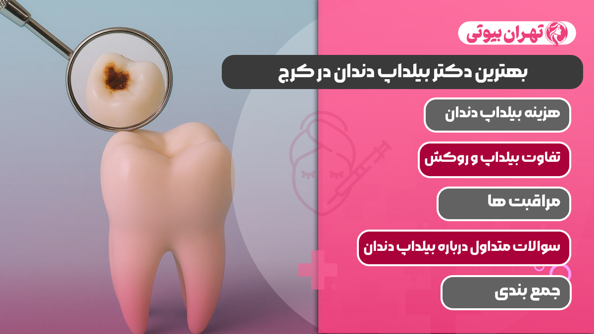 10 بهترین دکتر بیلداپ دندان در کرج