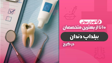 10 بهترین دکتر بیلداپ دندان در کرج