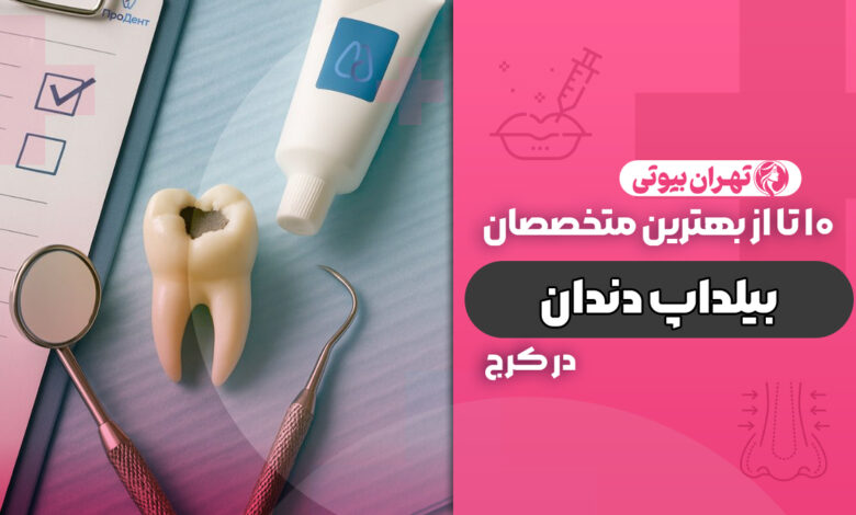 10 بهترین دکتر بیلداپ دندان در کرج