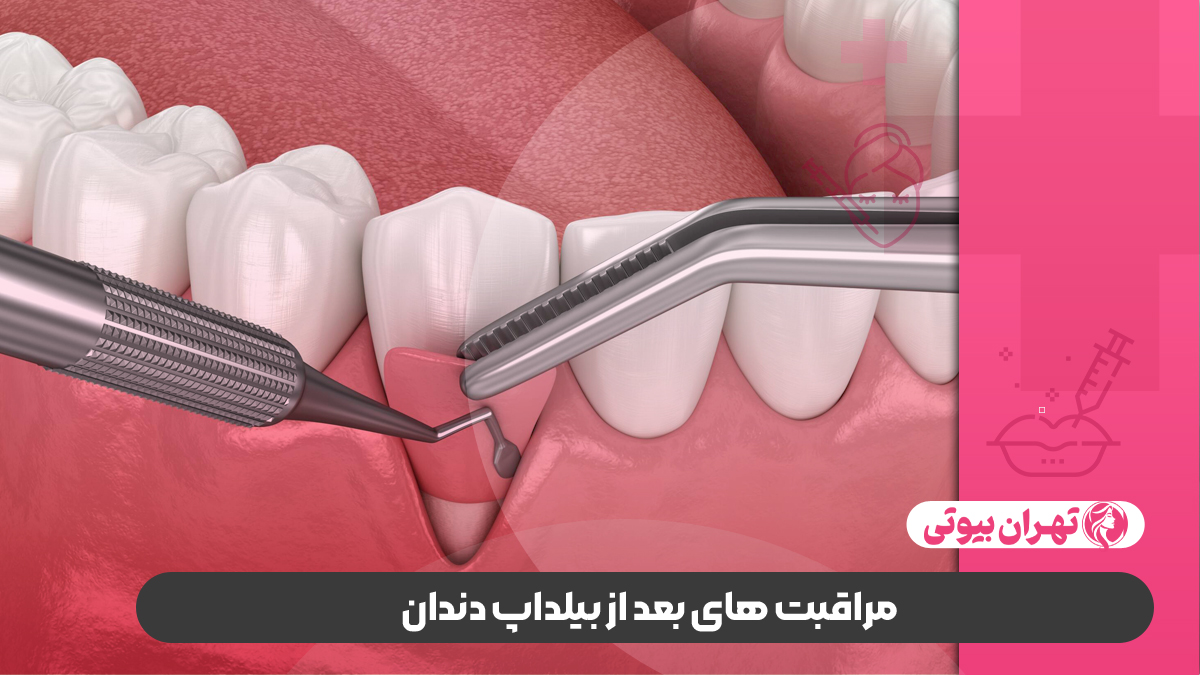 10 بهترین دکتر بیلداپ دندان در کرج