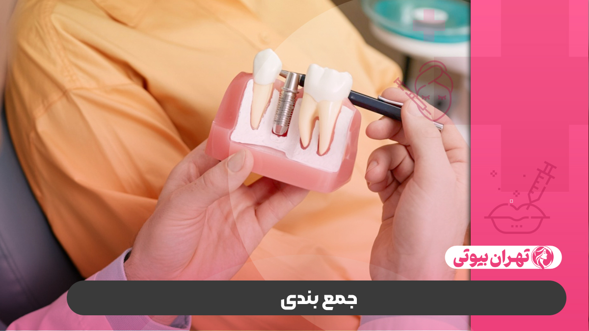 10 بهترین دکتر بیلداپ دندان در کرج