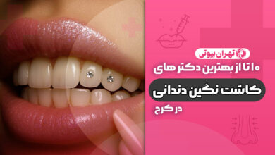 10 بهترین دکتر کاشت نگین دندانی در کرج