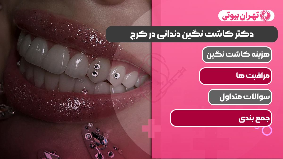 10 بهترین دکتر کاشت نگین دندانی در کرج