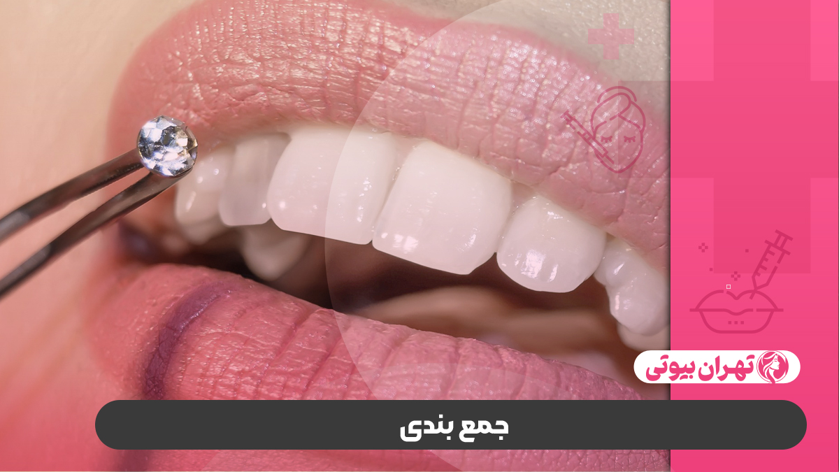 10 بهترین دکتر کاشت نگین دندانی در کرج