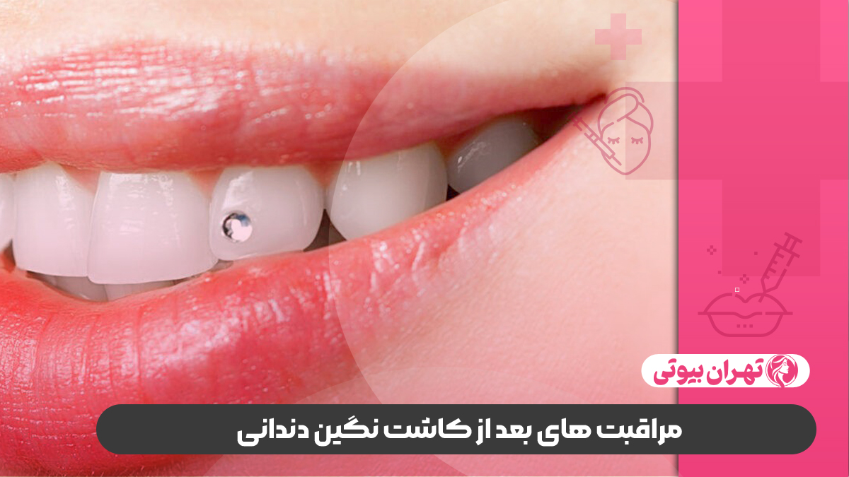 10 بهترین دکتر کاشت نگین دندانی در کرج